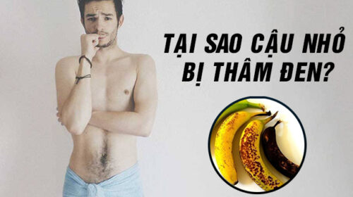 cậu nhỏ bị thâm đen